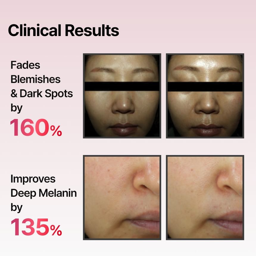 Meditherapy - Arbutin Skin Booster Set - Gallery 5