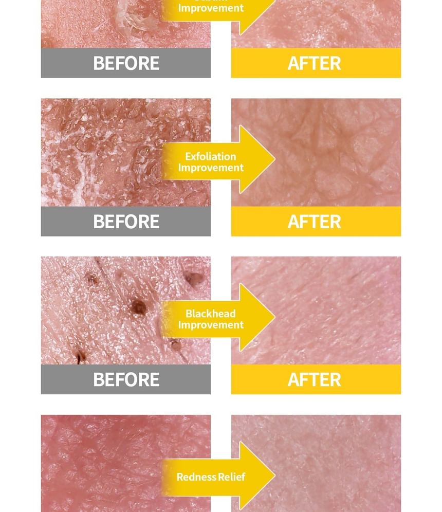 Secret Key - Lemon Sparkling Peeling Gel - Gallery 23