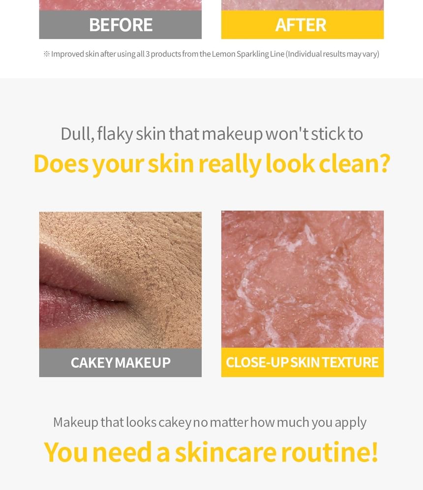 Secret Key - Lemon Sparkling Peeling Gel - Gallery 24