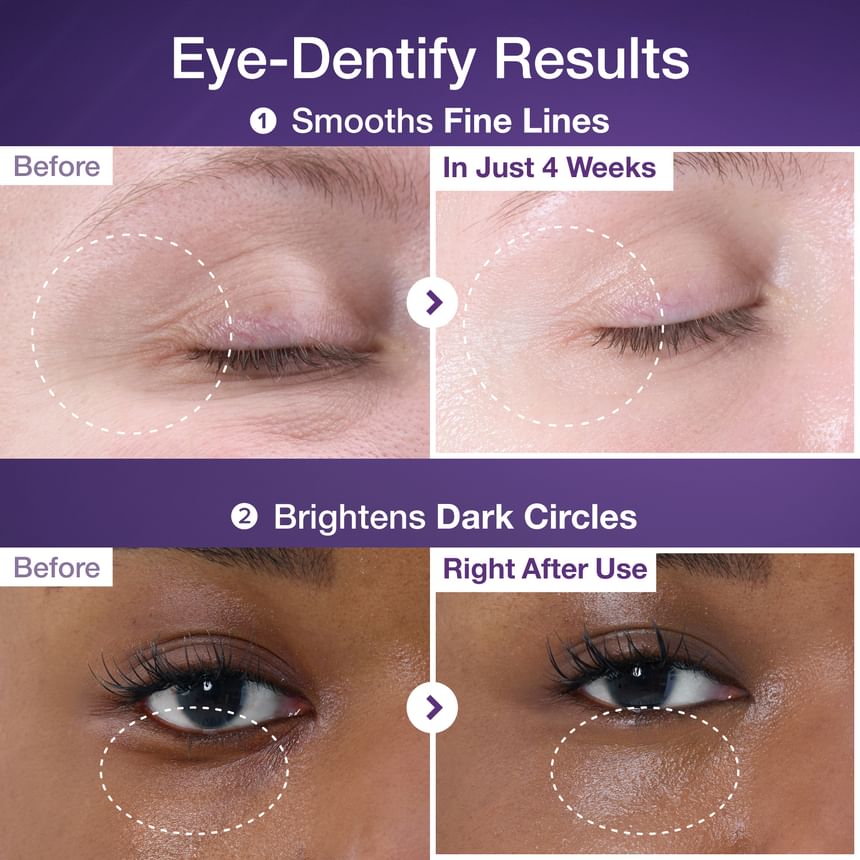 numbuzin - No.9 3 Days Eye Care Kit - Gallery 2