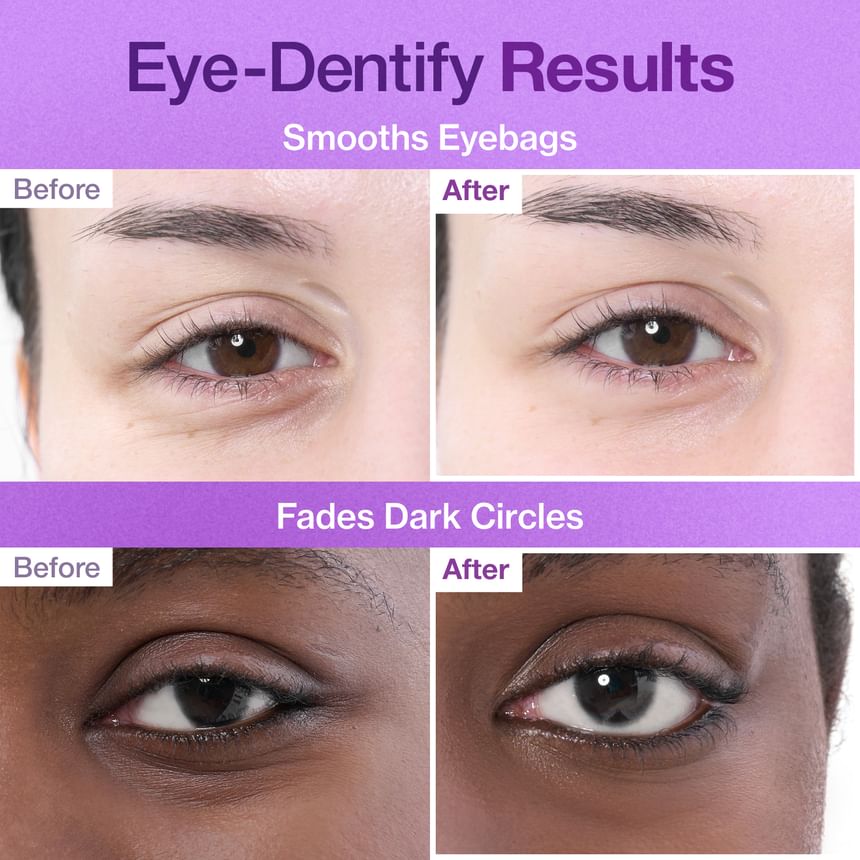 numbuzin - No.9 3 Days Eye Care Kit - Gallery 10