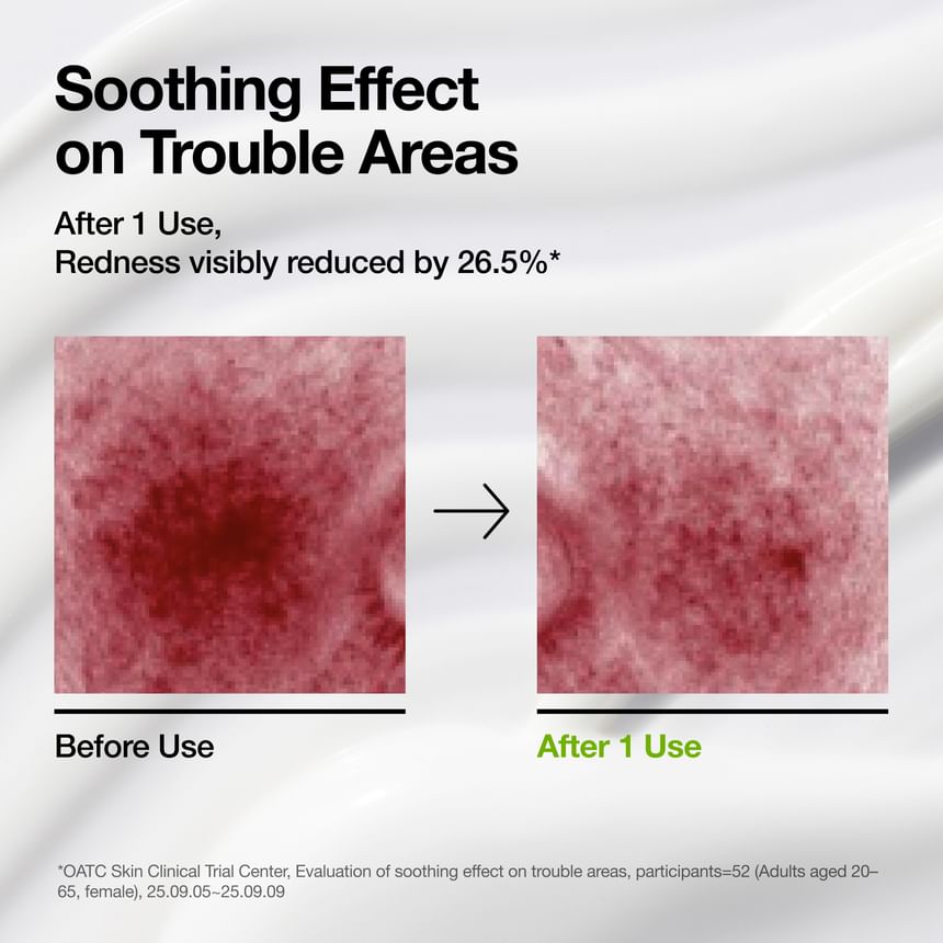 Anua - Azelaic Acid Cica Skin Soothing Moisturizer - Gallery 3