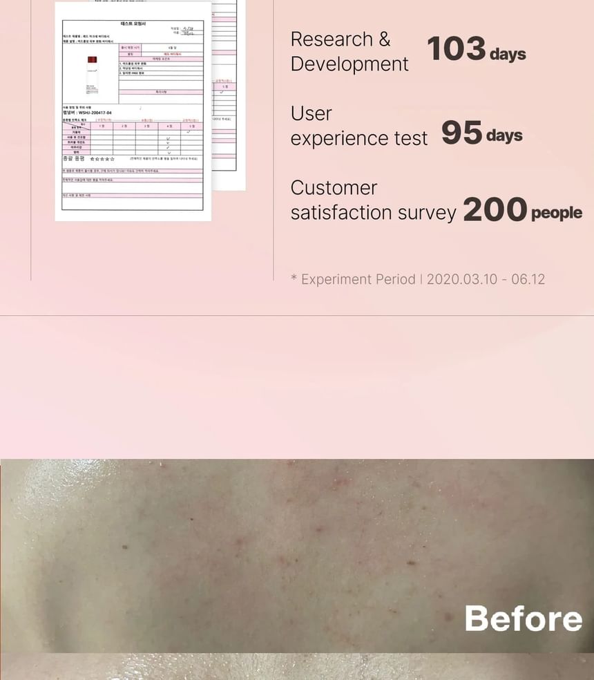 medicube - Red Acne Body Wash - Gallery 17