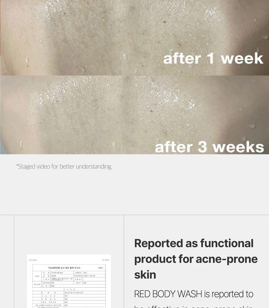 medicube - Red Acne Body Wash - Gallery 18