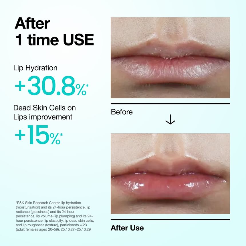 Anua - PDRN Lip Serum - Gallery 3