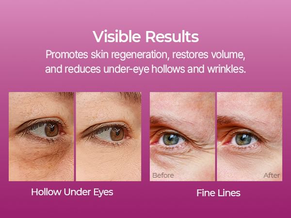 Dr.Melaxin - Cemenrete Calcium Volume Multi Balm - Gallery 4