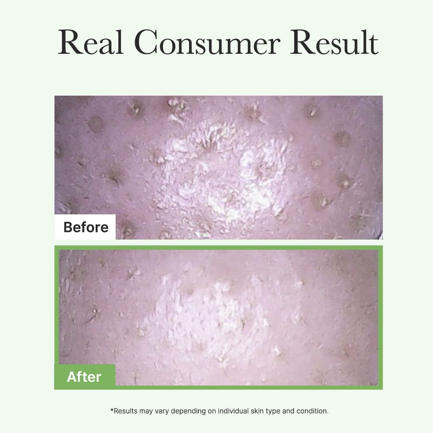 Arencia - Pore Melt Mochi Cleansing Oil 200ml - Gallery 7