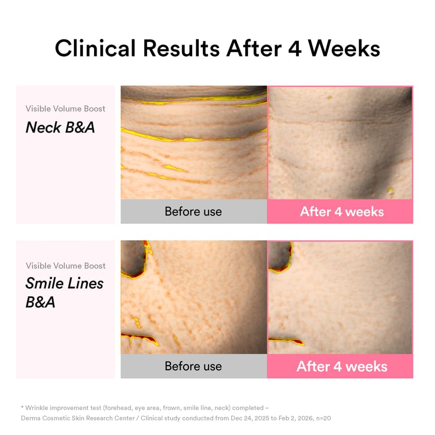 Abib - PDRN Volume Fill-it Booster Crème 2.5 Tube - Gallery 5