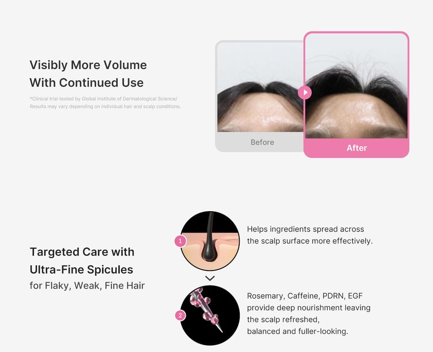 Medicube - Rosemary PDRN Scalp Serum - Gallery 2