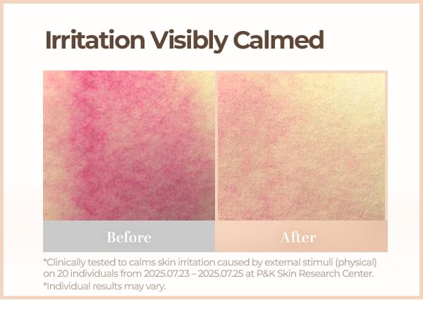 Cell Fusion C - Skin Blemish Balm Intensive - 6 Colors - Gallery 12
