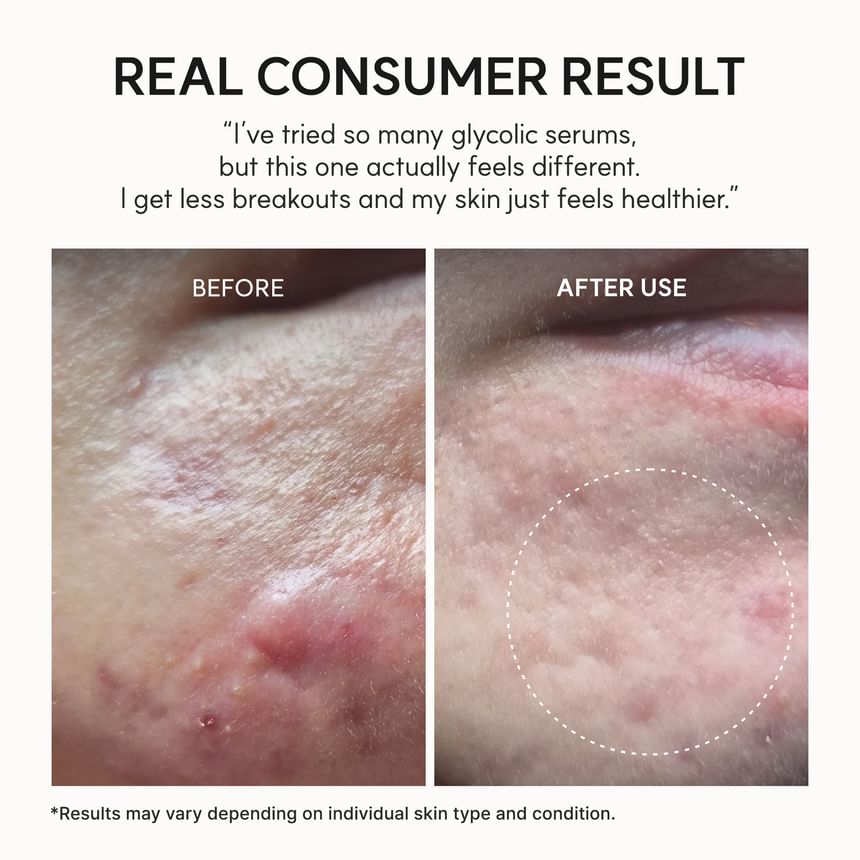 Arencia - Eraser Shot Glycolic Acid Booster - Gallery 6