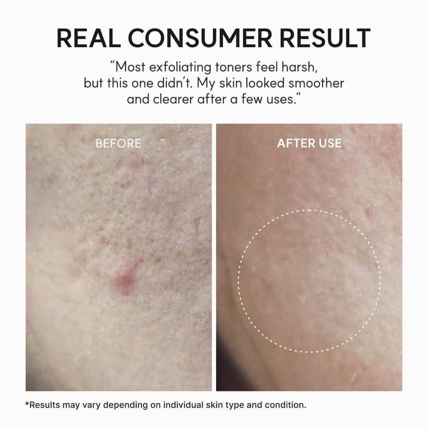 Arencia - Eraser Shot Glycolic Acid Exfoliator 200ml - Gallery 7