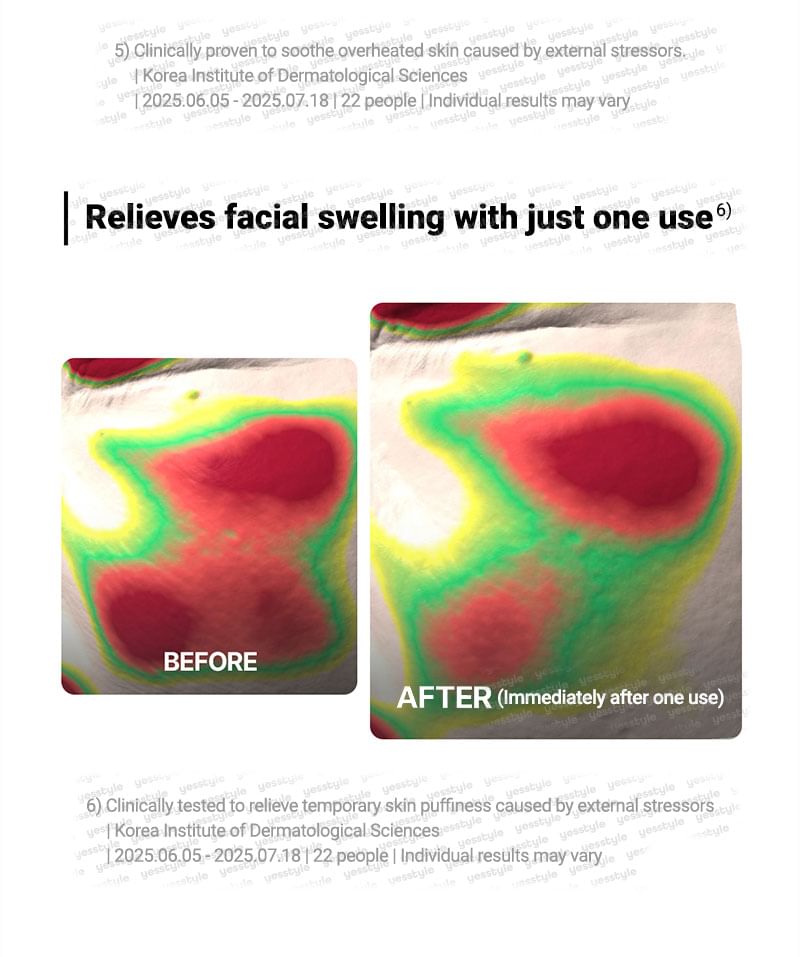 Centellian24 - Expert Madeca Cream Active Renew PDRN - Gallery 14