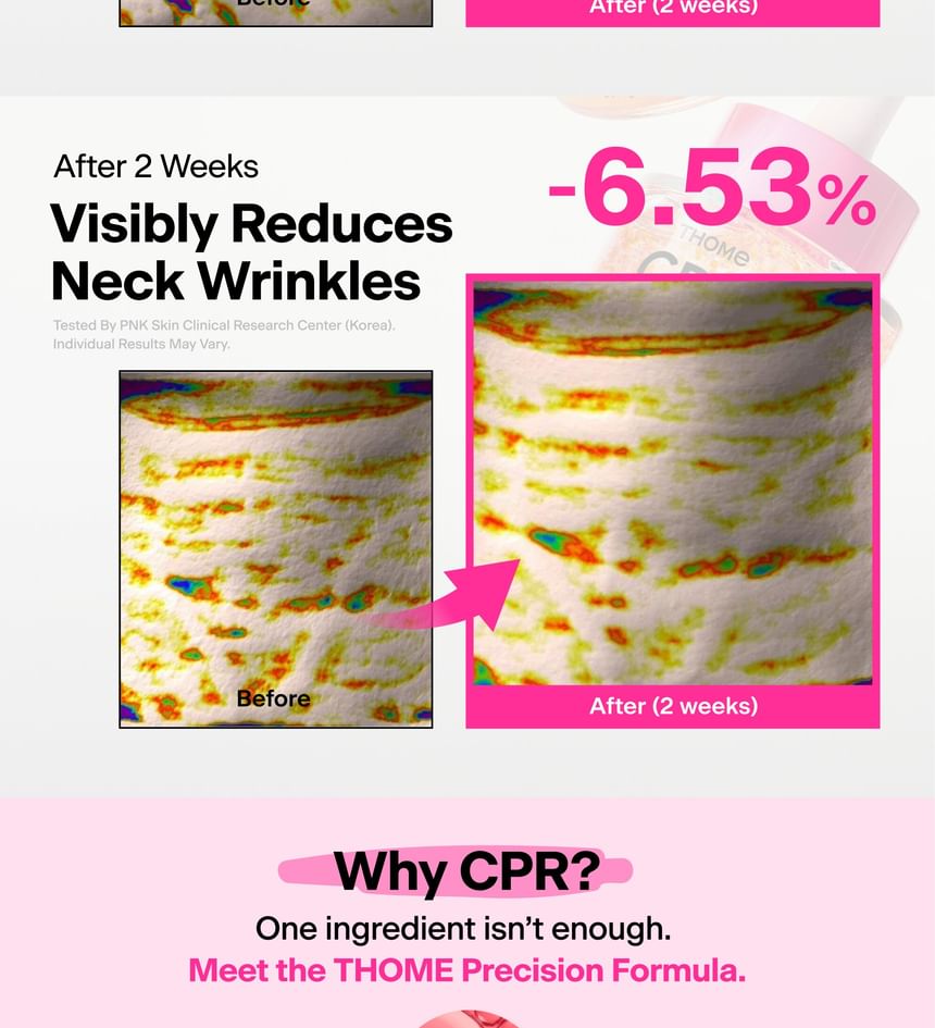 THOME - CPR Triple-Synergy Wrinkle Care Serum 30ml - Gallery 5