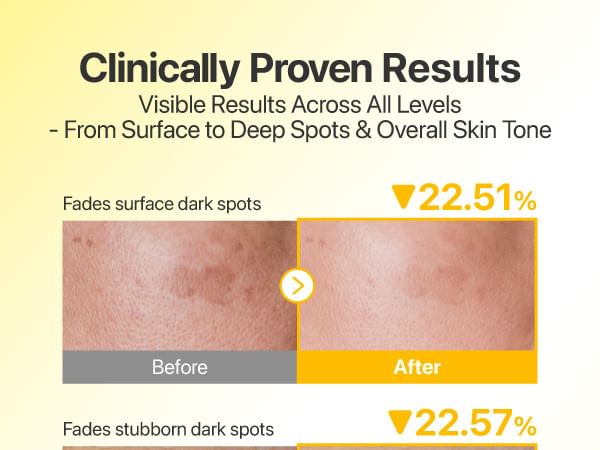 numbuzin - No.5 Glutathione Vitamin Tone-up Sun Serum - Gallery 3