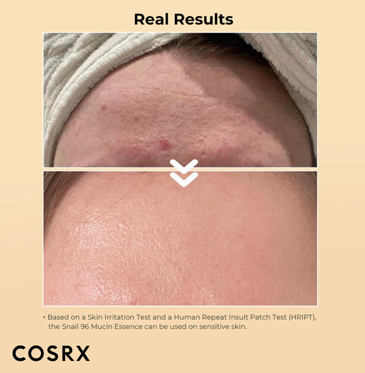 COSRX - Advanced Snail 96 Mucin Power Essence