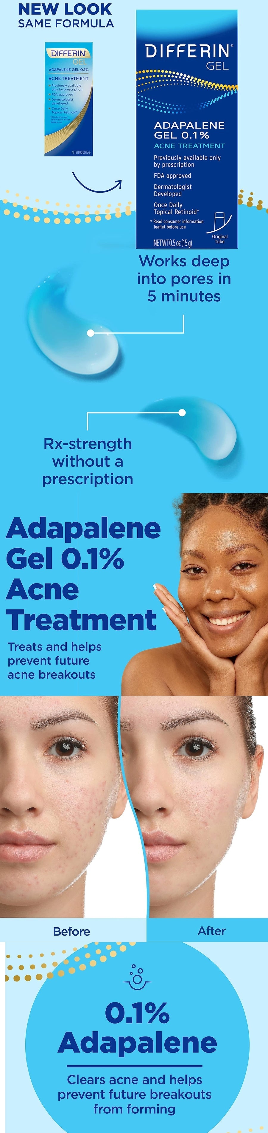 Differin GEL Adapalene GEL 0.1% ACNE TREATMENT - Gallery 1