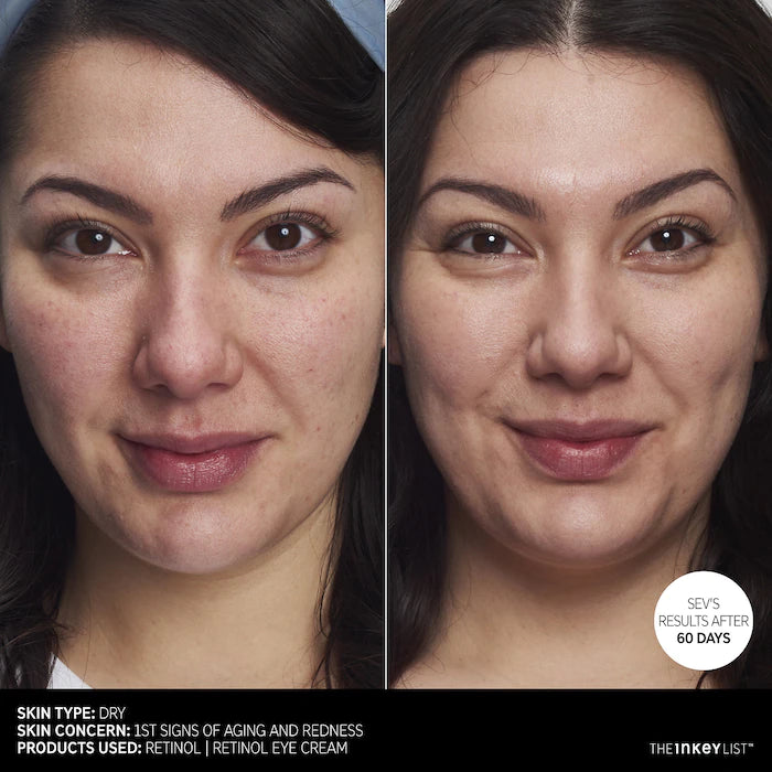 The INKEY List Retinol Anti-Aging Serum