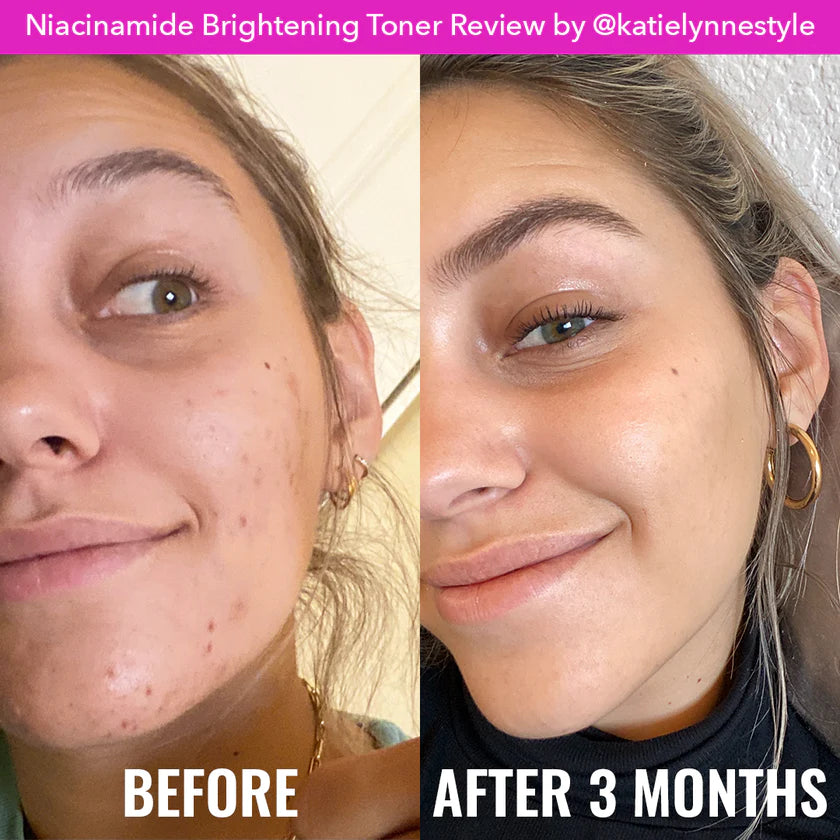 Good Molecules - Niacinamide Brightening Toner