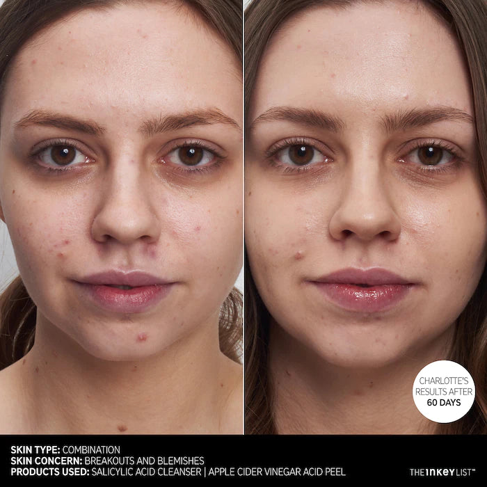 The INKEY List Salicylic Acid Acne + Pore Cleanser