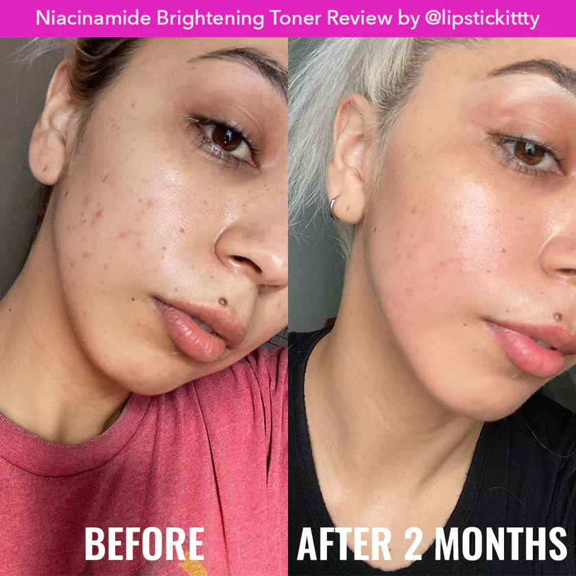 Good Molecules - Niacinamide Brightening Toner